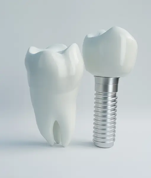 インプラントの無料相談はこちら