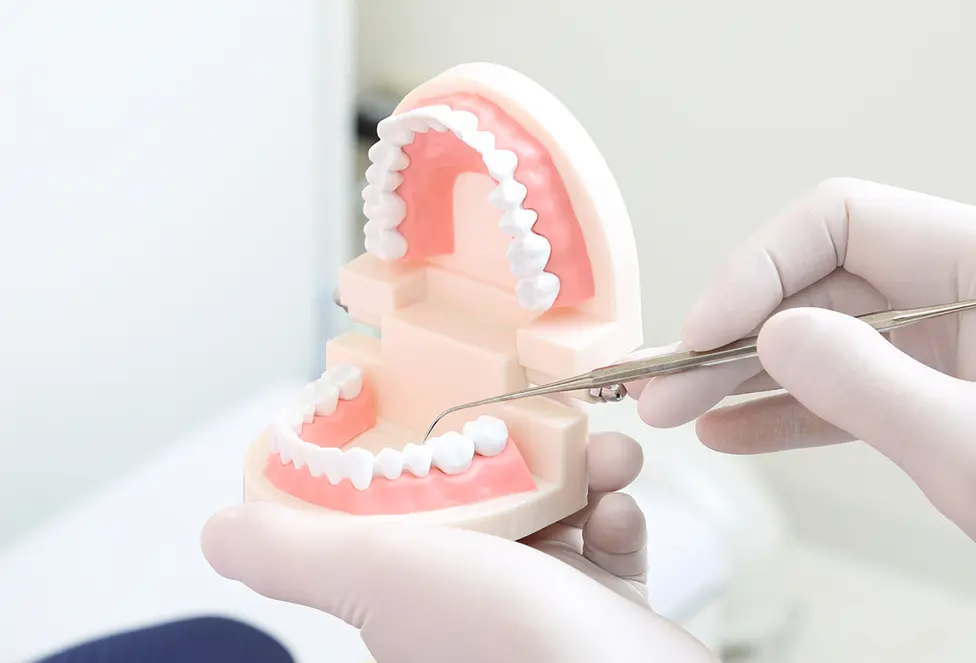 周囲の歯への負担を抑えられる