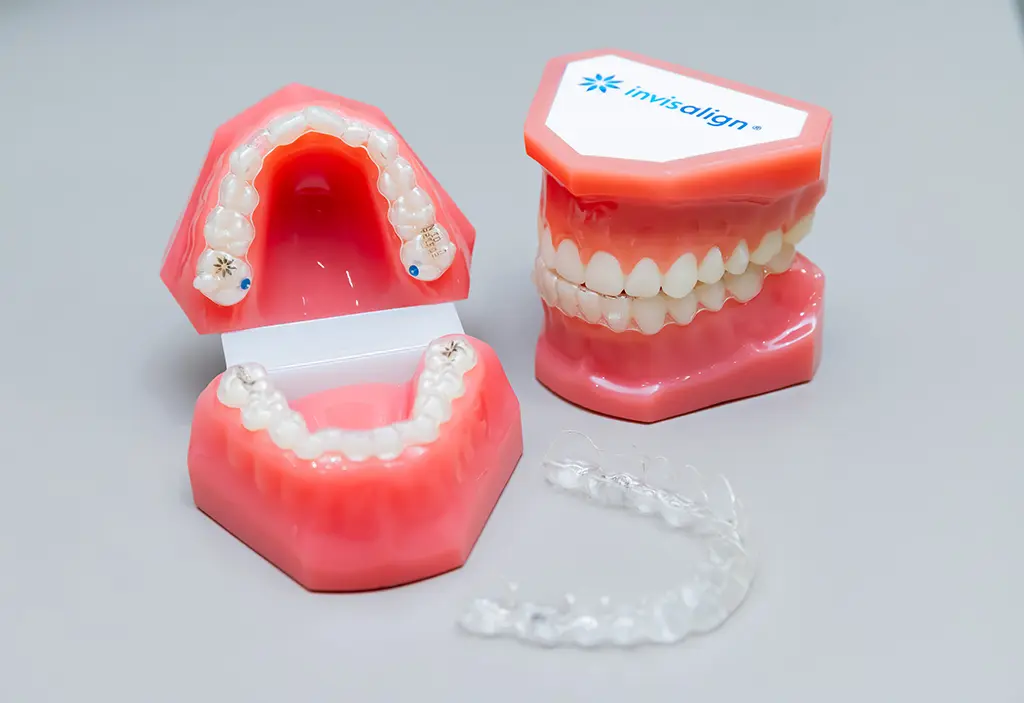 矯正装置の製作