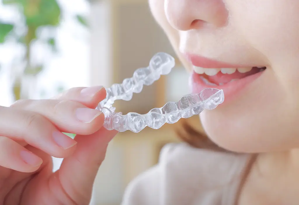 矯正治療スタート